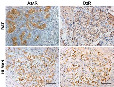 Experimental Evidence of A2A–D2 Receptor–Receptor Interactions in the Rat and Human Carotid Body